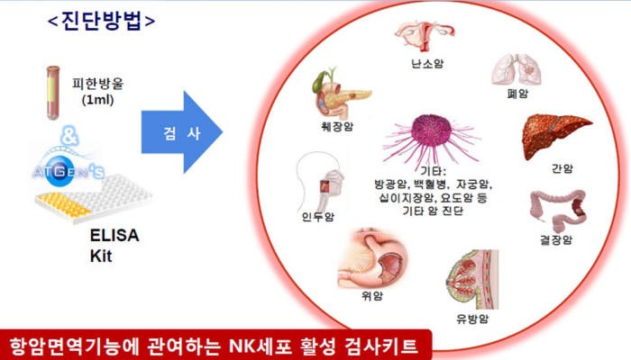 에이티젠이 이번에 출시한 '엔 케이 뷰 키트'의 진단방법