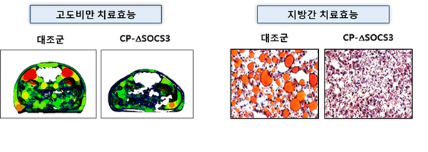 CP-deltaSOCS3의 비만 치료효능 (좌: 복부 마이크로 CT 사진 - 빨간색이 지방) 및 지방간 치료효능 (우: 간조직 - 크고 둥근 붉은색 지방덩어리］