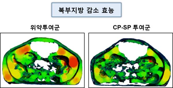 ［사진설명: CP-SP의 비만 치료효능 (복부지방 감소: 붉은색이 지방)］