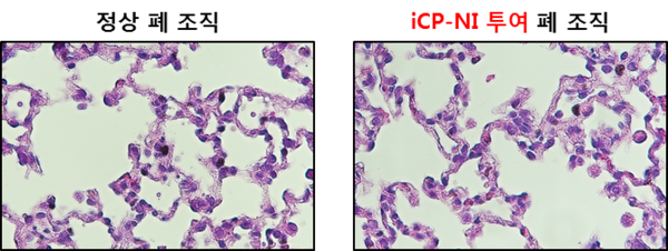 최고농도 iCP-NI를 5일간 반복 투여 후 정상 폐 조직과 차이 없는 무독성 조직병리 결과