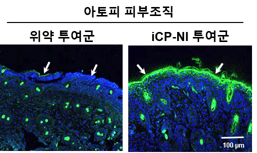 [사진설명: 아토피 피부염 동물모델에서 붕괴된 피부구조 (왼쪽)를 회복시켜 아토피를 치료함 (오른쪽, 녹색: 피부장벽 단백질)]