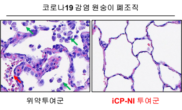 [코로나19 감염 원숭이의 폐 조직파괴 치료효능: 위약투여군에서 면역세포 침윤 (녹색 화살표)과 출혈 (붉은색 화살표)이 보이는 것과 달리, iCP-NI 투여군에서는 조직파괴가 발견되지 않음]