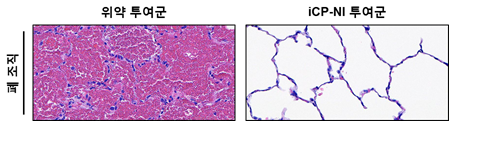 코로나19 바이러스 감염으로 인해 폐 내 극심한 출혈과 파괴가 진행되는 것에 비해 (왼쪽) , iCP-NI 투여로 폐 조직(오른쪽)이 정상구조를 유지.