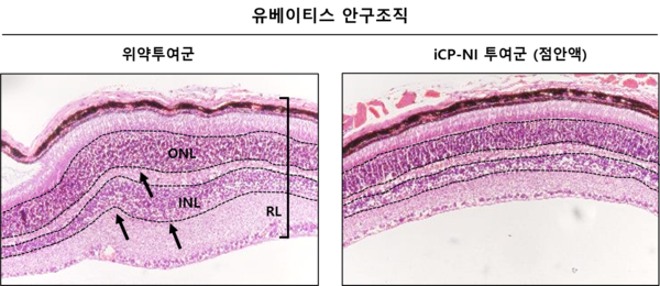 [사진설명: 안구 자가면역질환 유베이티스 모델에서 염증으로 두꺼워지고 딱딱해져 변형된 망막층 (retinal layer: RL) 및 붕괴된 내, 외 과립층 (inner & outer nuclear layer: INL & ONL) 안구구조 (왼쪽, 화살표: 휘고 두껍게 변형된 구조)를 iCP-NI가 회복시킴 (오른쪽)]