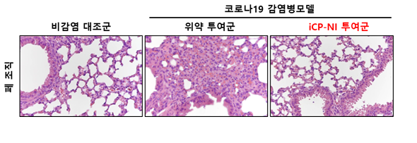생물무기 (bioweapon)로 사용되는 슈퍼항원 (super antigen) 접종으로 유도된 코로나19 감염병 폐조직 손상모델은 산소교환을 위한 폐 다공성 구조와 기능을 상실 (가운데) 하였으나, iCP-NI 투여군 (오른쪽)의 폐 조직은 비감염 대조군 (왼쪽)과 동일하게 폐조직 파괴 없음]