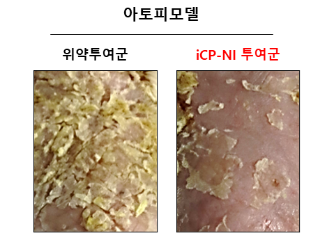 아토피피부염 동물모델에서 연고제형 iCP-NI의 치료효능