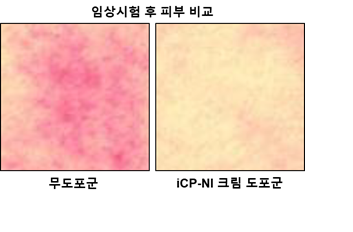 헬스케어사업 진출을 위한 성인 대상 임상시험 결과. 사진/셀리버리