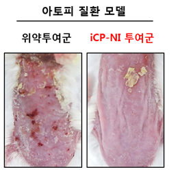 면역염증치료신약 iCP-NI를 아토피피부염 질환모델에 피하주사 (SC) 투여 시 치료효능: 피부 표면 각질화가 회복되어 아토피피부염이 치료됨. 사진/셀리버리