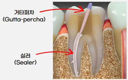 사진/홈플란트치과
